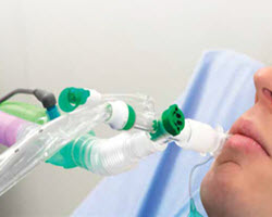 Intersurgical TrachSeal closed suction systems